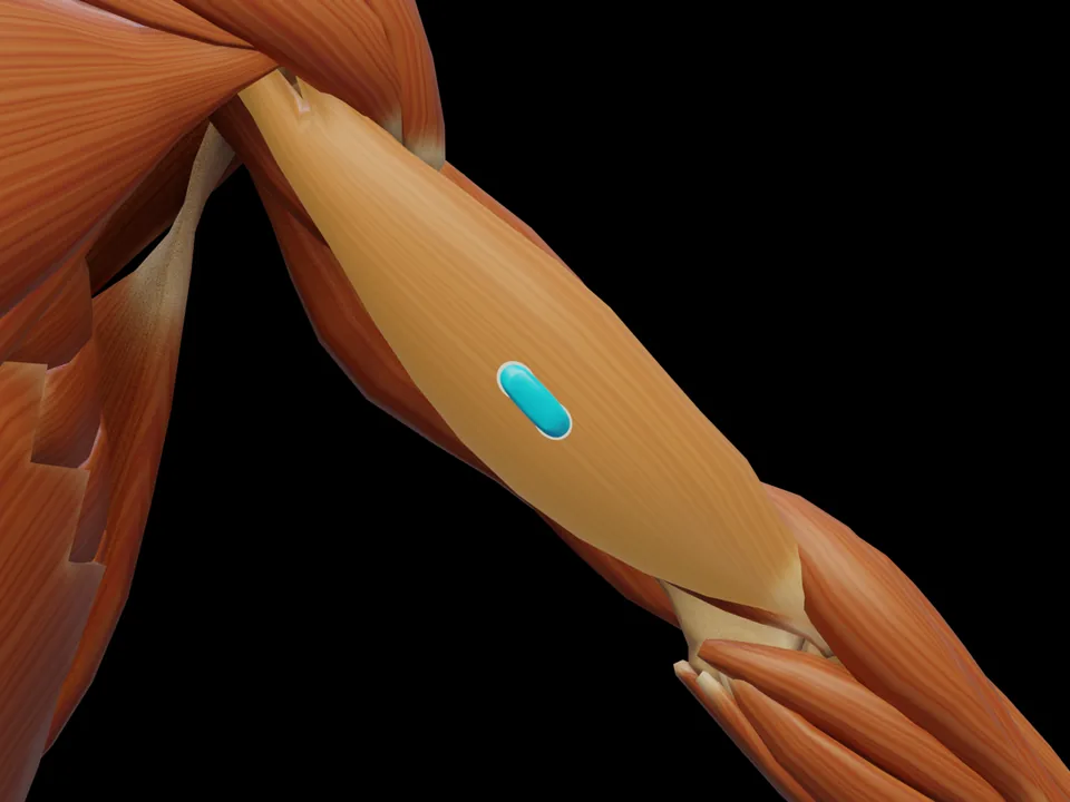 Electrode position on the 3D model: M. Biceps Brachii (muscle highlighted, sensor in place)