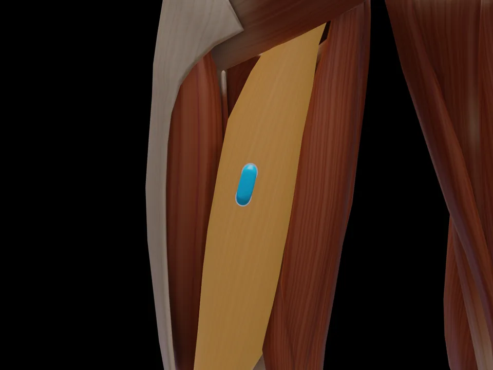 Electrode position on the 3D model: M. Biceps Femoris Caput Longum (muscle highlighted, sensor in place)