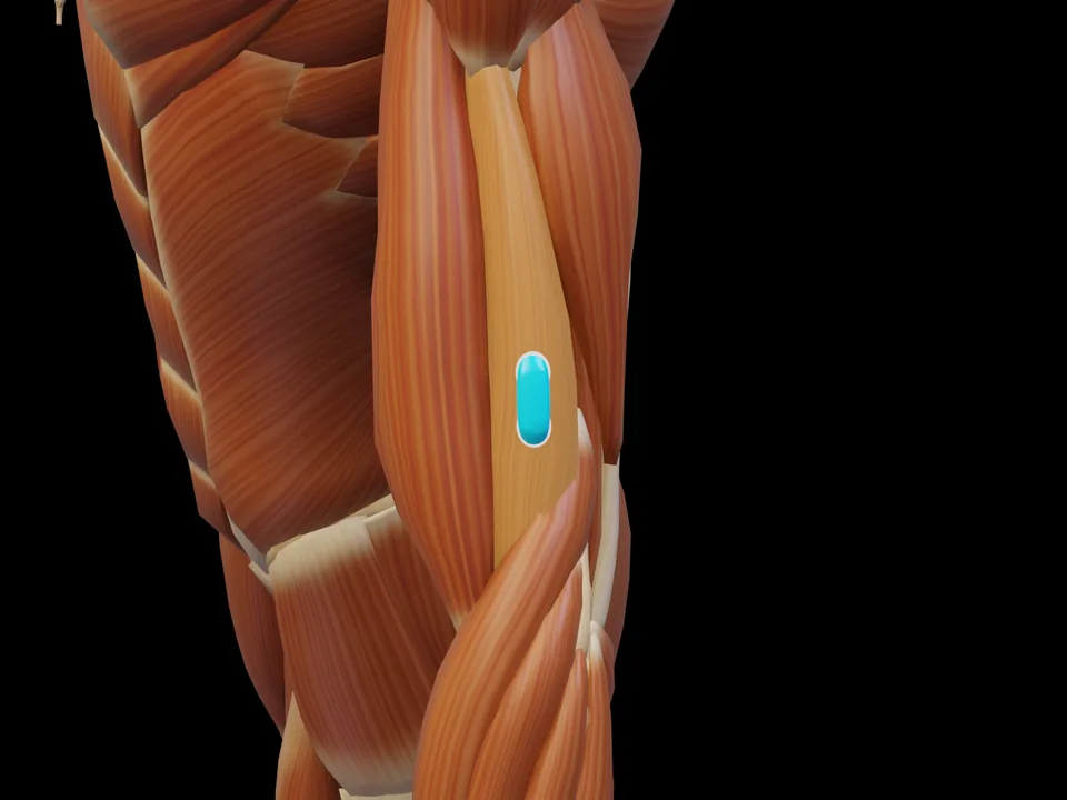 Electrode position on the 3D model: M. Brachialis (muscle highlighted, sensor in place)