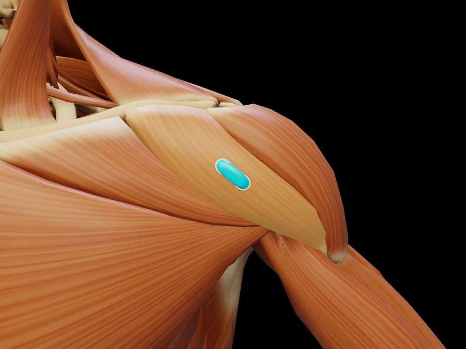 Electrode position on the 3D model: M. Deltoideus Pars Clavicularis (muscle highlighted, sensor in place)