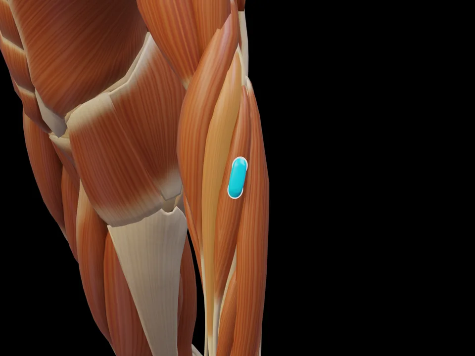 Elektrodenposition am 3D-Modell: M. Extensor Carpi Radialis Longus (Muskel hervorgehoben, Sensor platziert)