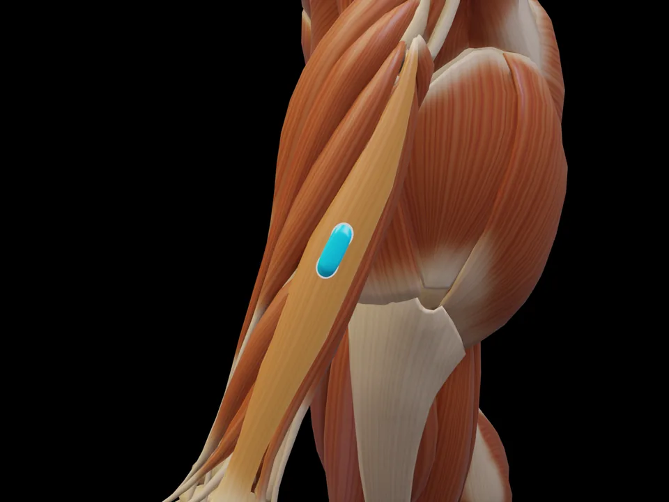 Elektrodenposition am 3D-Modell: M. Extensor Digitorum (Muskel hervorgehoben, Sensor platziert)