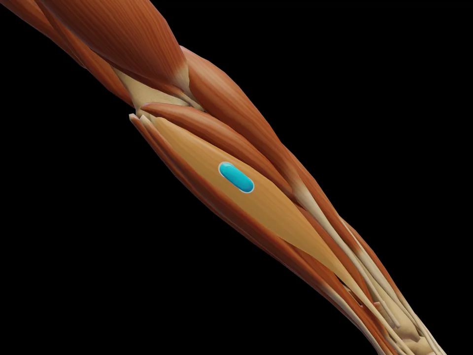 Electrode position on the 3D model: M. Flexor Carpi Radialis (muscle highlighted, sensor in place)