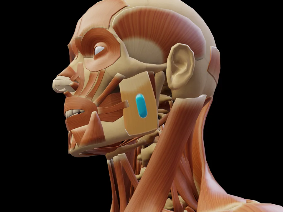 Electrode position on the 3D model: M. Masseter (muscle highlighted, sensor in place)
