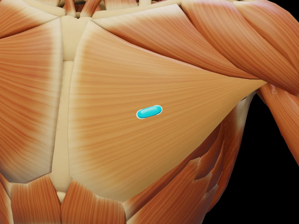 Elektrodenposition am 3D-Modell: M. Pectoralis Major Pars Sternocostalis (Muskel hervorgehoben, Sensor platziert)