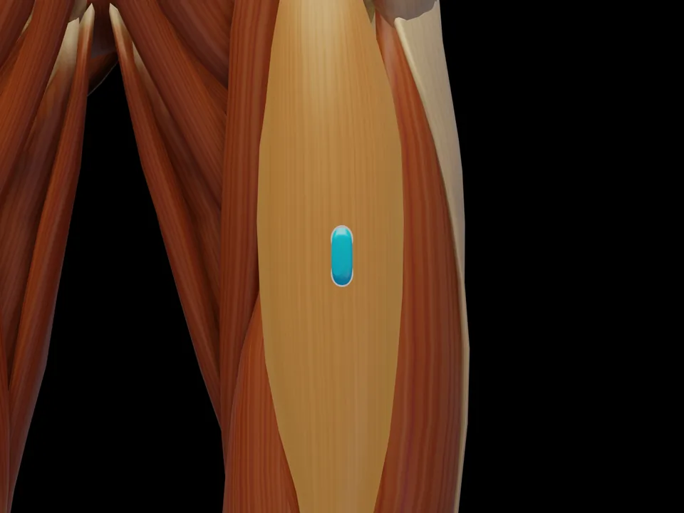 Electrode position on the 3D model: M. Rectus Femoris (muscle highlighted, sensor in place)