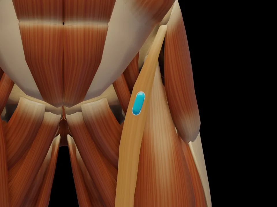 Electrode position on the 3D model: M. Sartorius (muscle highlighted, sensor in place)