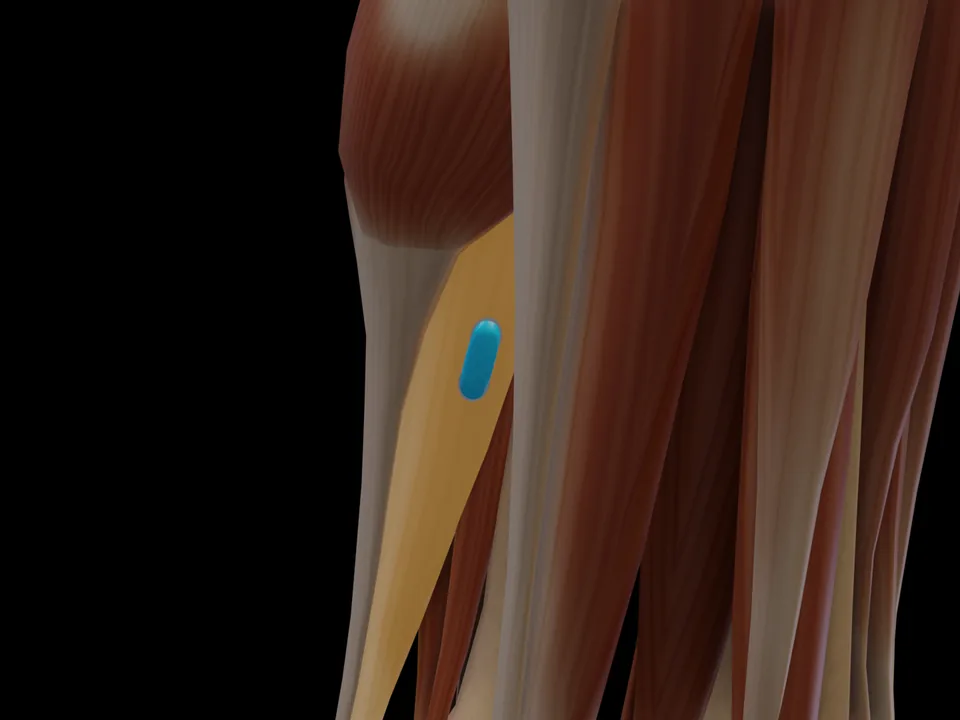 Electrode position on the 3D model: M. Soleus (muscle highlighted, sensor in place)