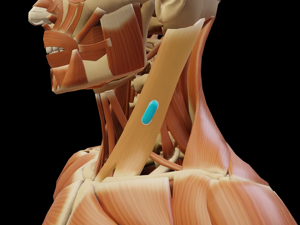 Elektrodenposition am 3D-Modell: M. Sternocleidomastoideus (Muskel hervorgehoben, Sensor platziert)