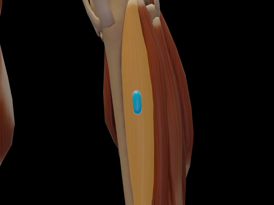 Elektrodenposition am 3D-Modell: M. Tibialis Anterior (Muskel hervorgehoben, Sensor platziert)