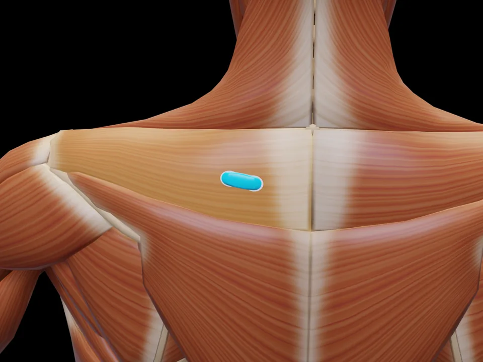 Elektrodenposition am 3D-Modell: M. Trapezius Pars Transversa (Muskel hervorgehoben, Sensor platziert)