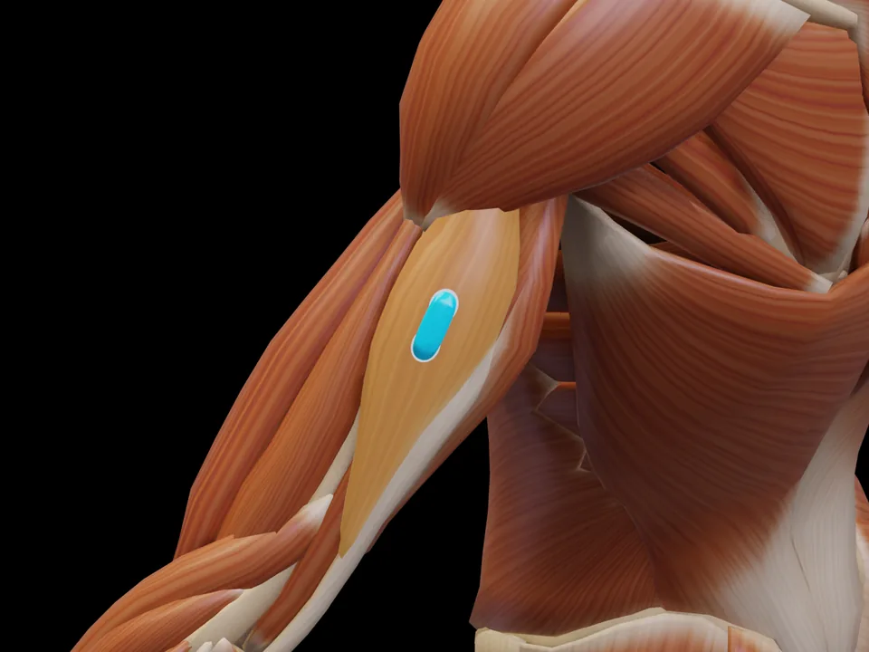 Electrode position on the 3D model: M. Triceps Brachii Caput Laterale (muscle highlighted, sensor in place)