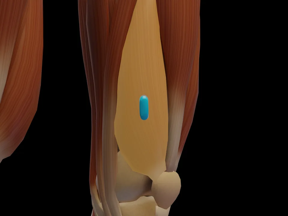 Electrode position on the 3D model: M. Vastus Medialis (muscle highlighted, sensor in place)