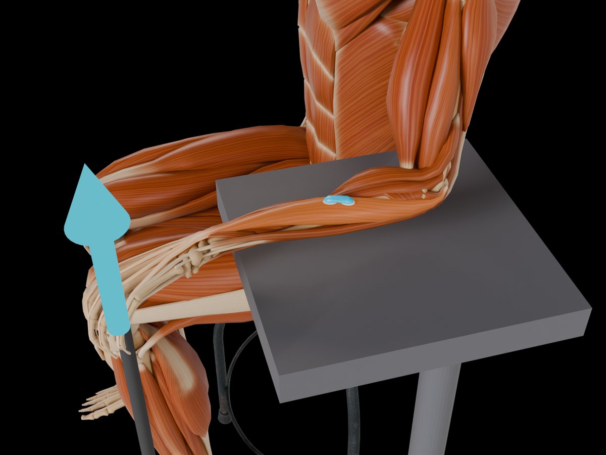 Detail: group test, sensor on the reference muscle of the group (M. Extensor Digitorum)
