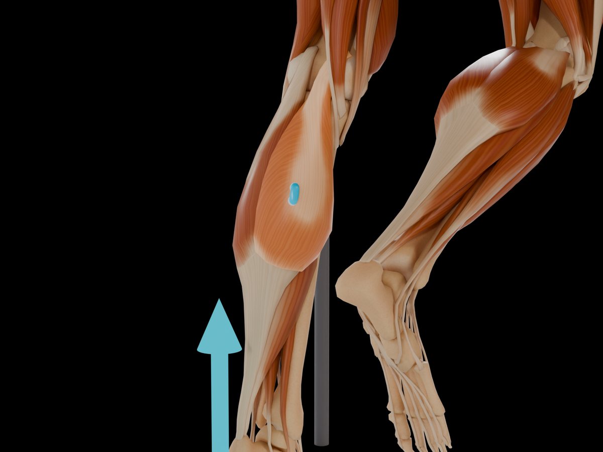 Detail: Sensor auf dem M. Gastrocnemius Caput Laterale