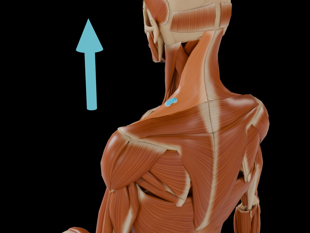 Detail: sensor on the M. Trapezius Pars Descendens