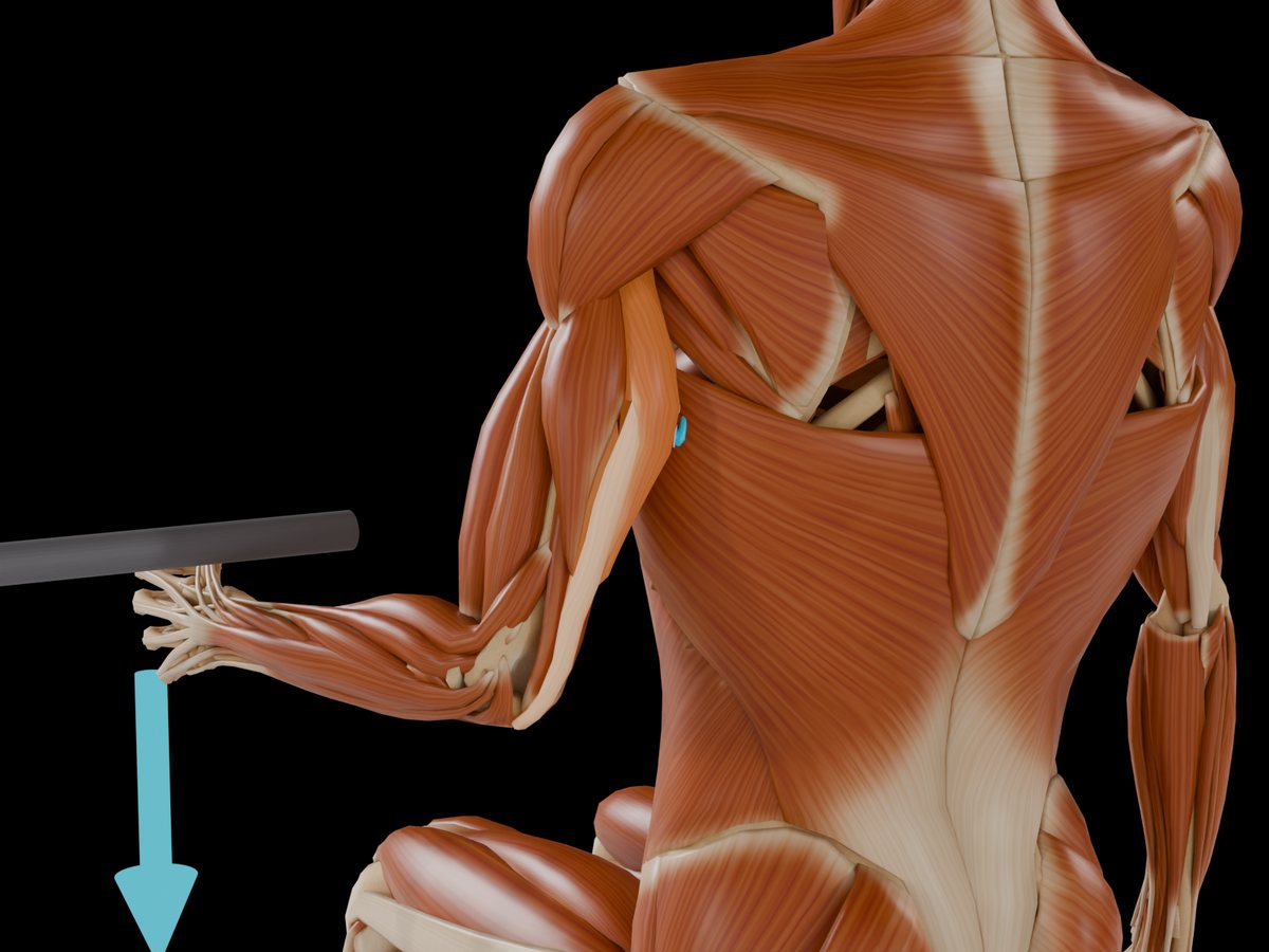 Detail: sensor on the M. Triceps Brachii Caput Laterale